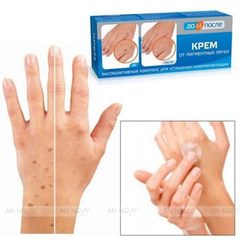 Kem Dưỡng Mờ Nám Tay Kpem Twins Tec Dưỡng Da Tay Mịn Màng 50ml