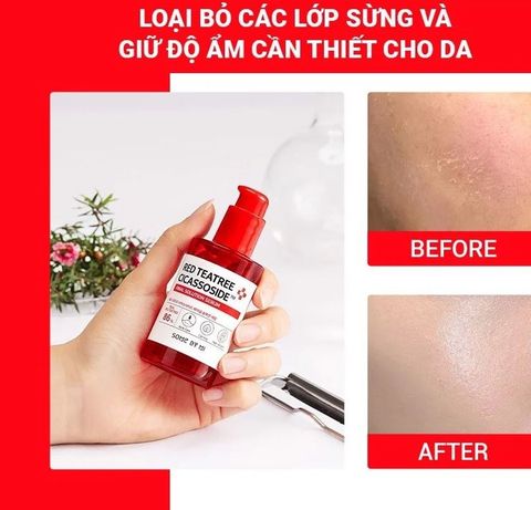 Tinh Chất Some By Mi Red Teatree Cicassoside Final Solution Serum 50ml