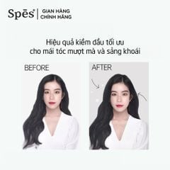 Dầu Gội Khô Spes Dry Shampoo