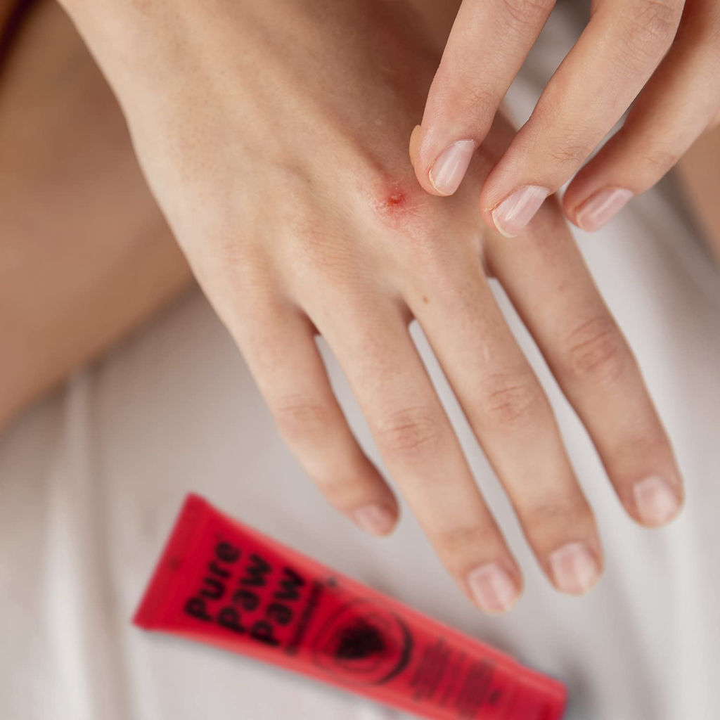 Dưỡng Môi Pure Paw Paw Ointment 25g