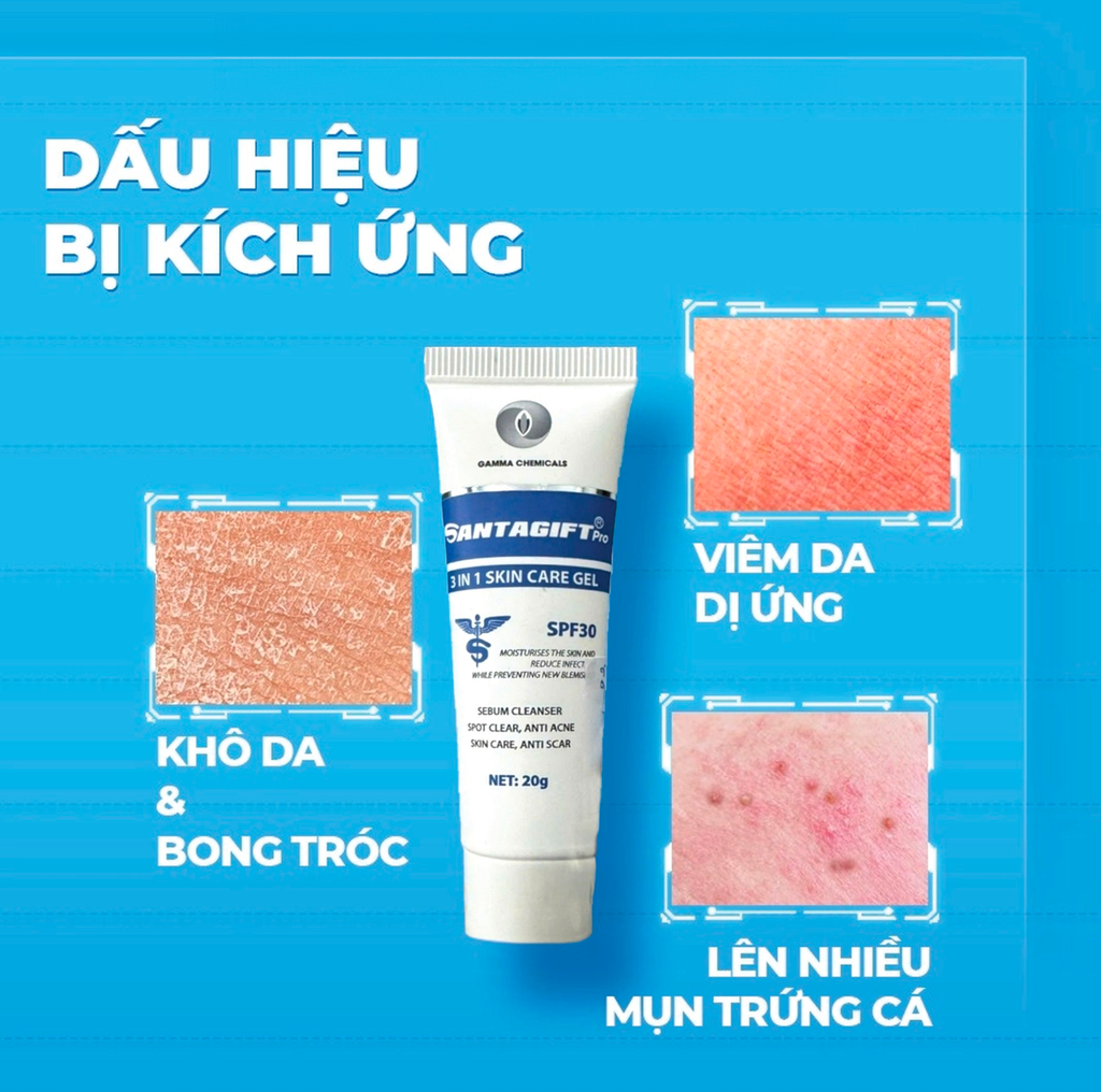 Gel Giảm Mụn Santagift 3 In 1 Skin Care Gel SPF30 Giảm Thâm, Ngừa Mụn 20g