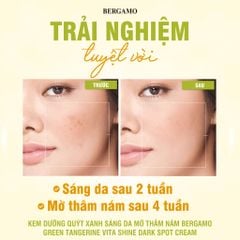 Kem Dưỡng Bergamo Green Tangerin Vita Shine Dark Spot Cream Chiết Xuất Quýt Xanh Hỗ Trợ Làm Trắng Da, Mờ Thâm Nám 50g