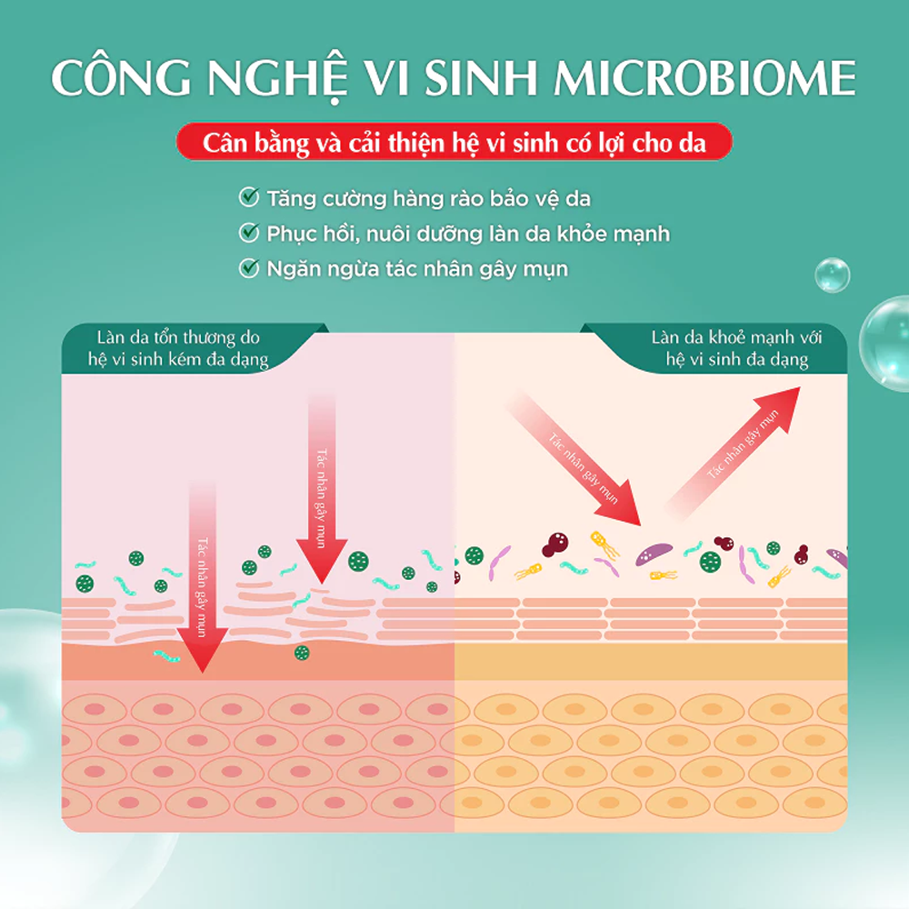Kem Dưỡng Hada Labo Acne Care Calming Gel Cream Cải Thiện Da Mụn 50g