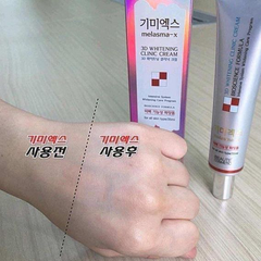 Kem Dưỡng Melasma-X 3D Whitening Clinic Renewal Cream Dưỡng Trắng Giảm Thâm Nám