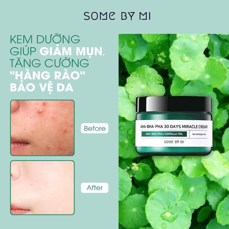 Kem Dưỡng Some By Mi AHA-BHA-PHA 30 Days Miracle Cream Hỗ Trợ Giảm Mụn 60g