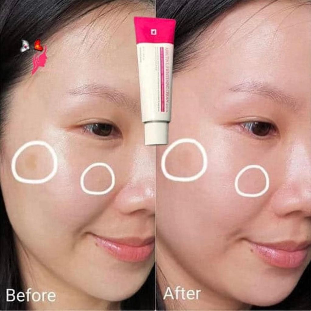 Kem Dưỡng Tosowoong Arbutin 5.0 Whitening Cream Dưỡng Trắng Da 50ml