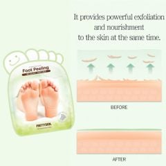 Mặt Nạ Chân PrettySkin Strong & Fast Foot Peeling Tẩy Da Chết, Mềm Da Chân 40ml