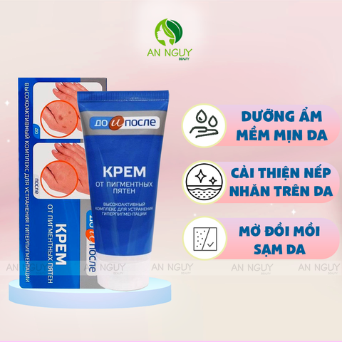 Kem Dưỡng Mờ Nám Tay Kpem Twins Tec Dưỡng Da Tay Mịn Màng 50ml