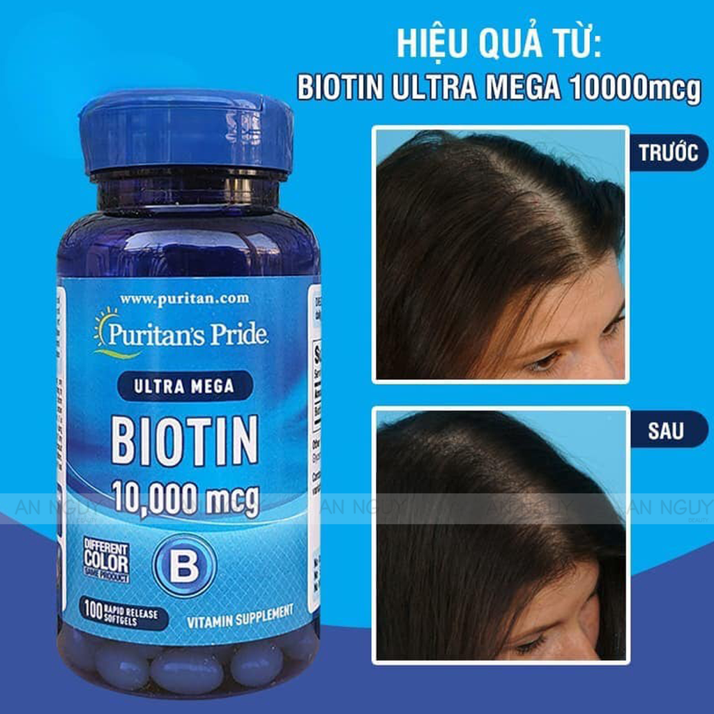 Viên Uống Puritans Pride Ultra Mega Biotin 10000 Mcg Kích Mọc Tóc 100 Viên