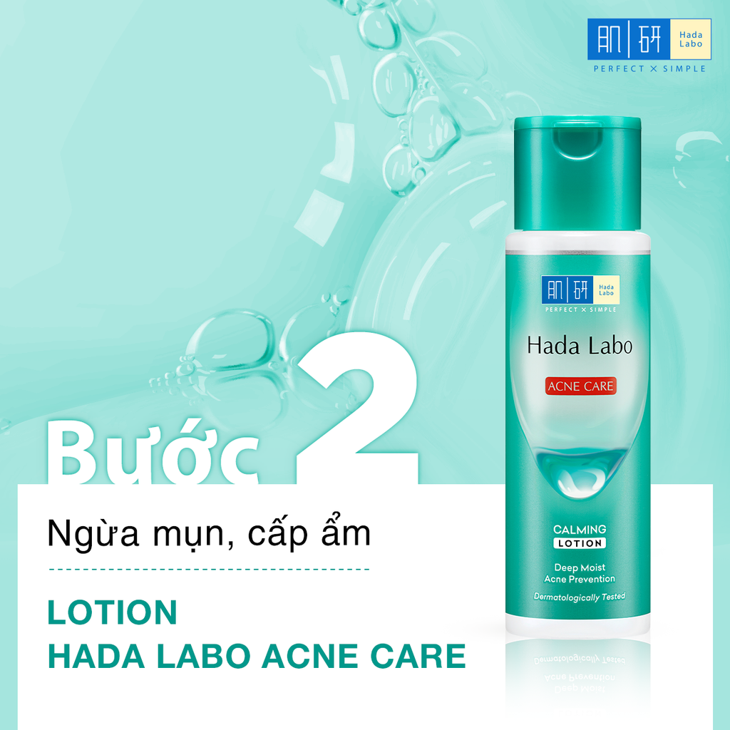 Dung Dịch Hada Labo Acne Care Calming Lotion Dưỡng Ẩm Cho Da Mụn 170ml