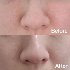 Nước Hoa Hồng Dạng Miếng Medicube Toner Pad