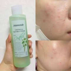 Nước Hoa Hồng Mamonde Toner Cân Bằng Độ Ẩm, Làm Dịu Da 250ml