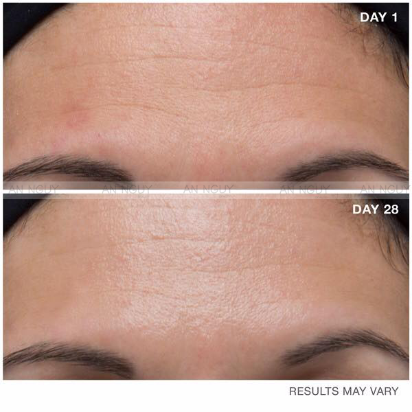 Tinh Chất Balance Snake Venom Anti-Ageing Giảm Nếp Nhăn, Chống Lão Hoá 30ml