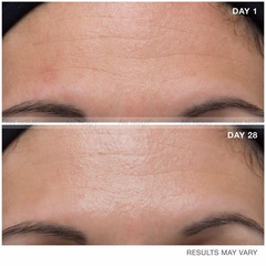 Tinh Chất Balance Snake Venom Anti-Ageing Giảm Nếp Nhăn, Chống Lão Hoá 30ml