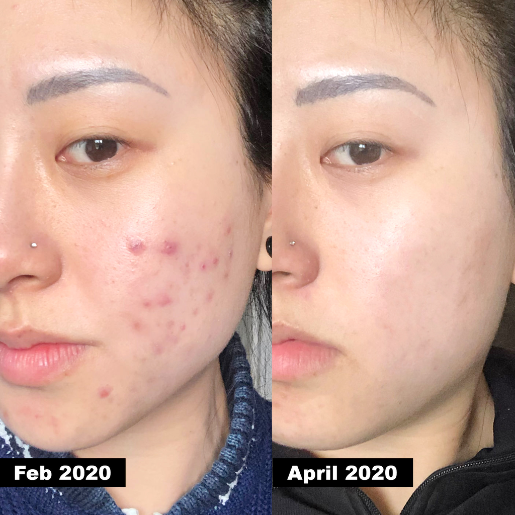 Sữa Rửa Mặt Cosrx Salicylic Acid Daily Gentle Cleanser Giảm Mụn 150ml