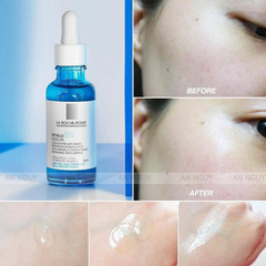 Tinh Chất La Roche-posay Hyalu B5 Chuyên Sâu Tái Tạo Da, Giúp Da Săn Chắc