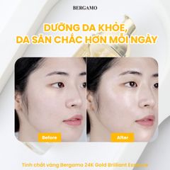 Tinh Chất Bergamo 24K Gold Brilliant Essence Chống Lão Hóa 110ml