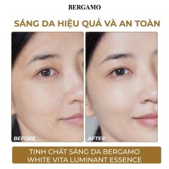 Tinh Chất Bergamo White Vita Luminant Essence Dưỡng Trắng Da 110ml