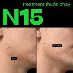 Tinh Chất Bí Đao Cocoon Winter Melon Serum N15 Giảm Bóng Nhờn Và Giảm Mụn 70ml