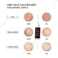 Tinh Chất Giảm Mụn Ekseption Hyaluronic ZnPCA Mixlab Serum Kiểm Soát Dầu 75ml