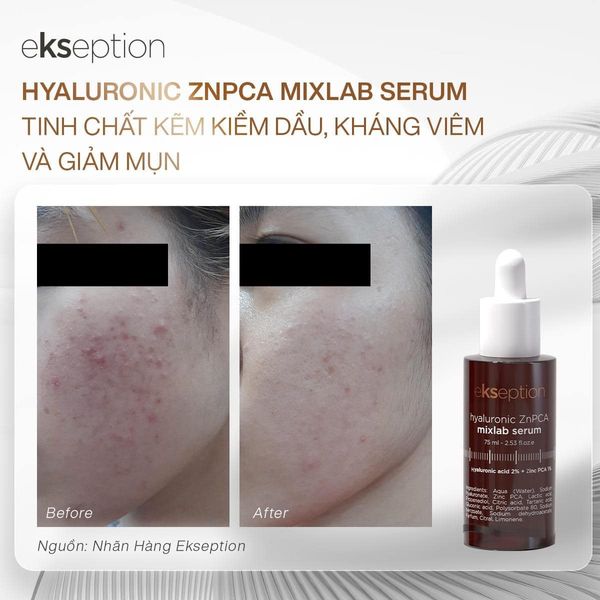 美容液 Ekseption Mixlab serum Hyaluronic Zn PCA HyaluronicZnPCA.png?v=1651930518