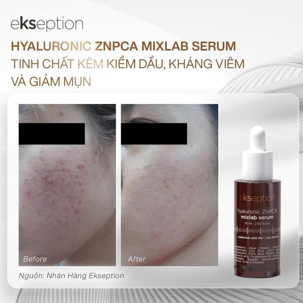 Tinh Chất Giảm Mụn Ekseption Hyaluronic ZnPCA Mixlab Serum Kiểm Soát Dầu 75ml
