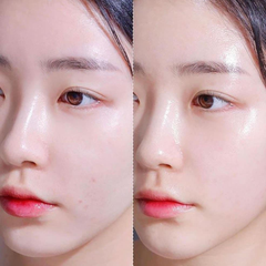 Tinh Chất ISOI Blemish Care Up Serum Dưỡng Trắng, Mờ Thâm Nám 15ml