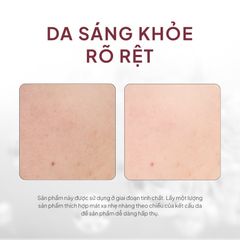 Tinh Chất Maxclinic Ampoule Dưỡng Da Toàn Diện 100ml