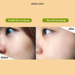 Tinh Chất Quýt Xanh Bergamo Green Tangerine Vita Shine Dark Spot Serum Hỗ Trợ Làm Trắng Da, Mờ Thâm Nám 50ml