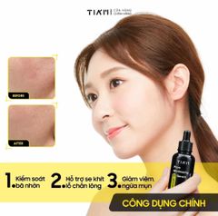 Tinh Chất Tia'm Pore Minimizing 21 Serum Giảm Dầu Nhờn 40ml