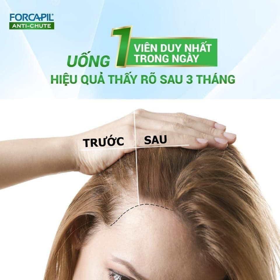 Viên Uống Giảm Rụng Tóc, Hói Đầu Arkopharma Forcapil Anti Chute 30 Viên