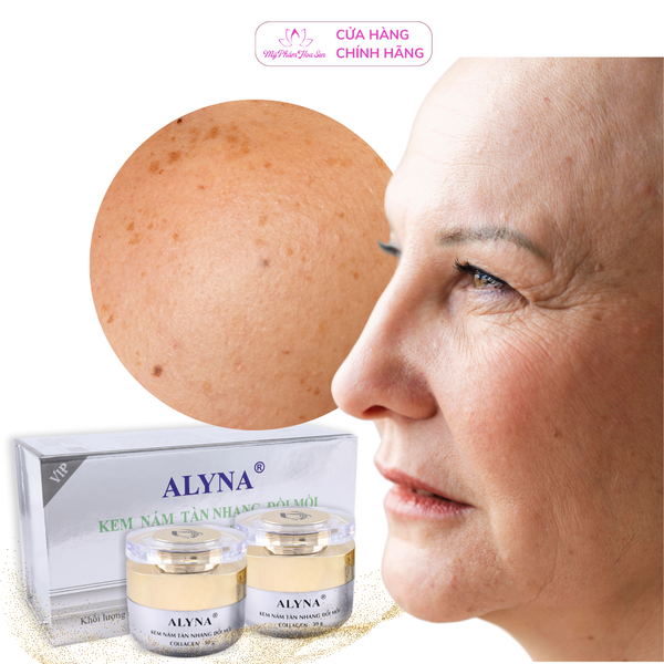 [ALYNA - KEM CẶP] Kem Ngừa nám, Tàn nhang, Đồi mồi