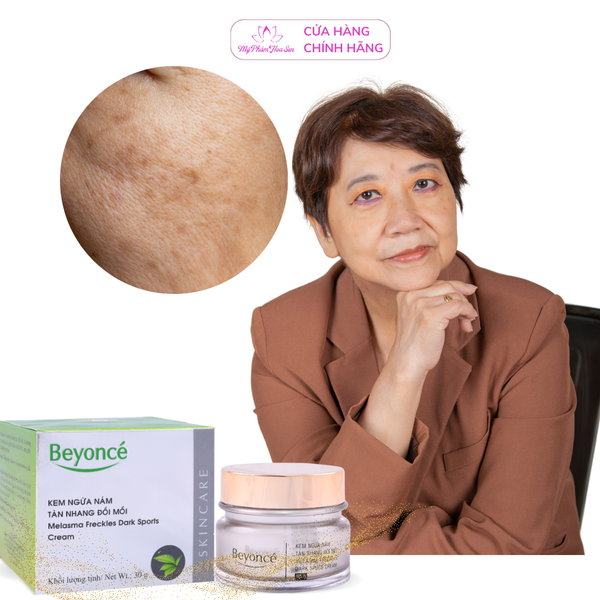 [BEYONCÉ] Kem Ngừa nám, Tàn nhang, Đồi mồi