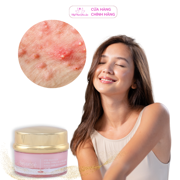 [BEYONCÉ] Kem Dưỡng trắng, Chống nắng, Ngừa mụn