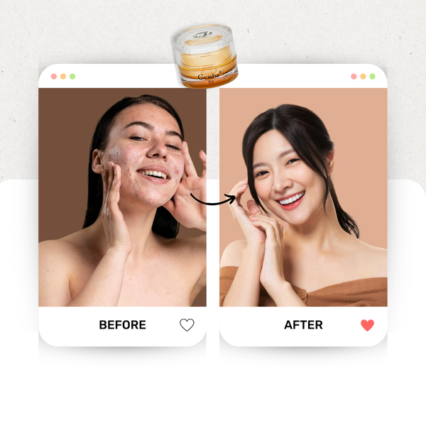 [GEISHA - DÒNG VIP] Kem Dưỡng trắng, Ngừa mụn, Ngừa lão hóa da