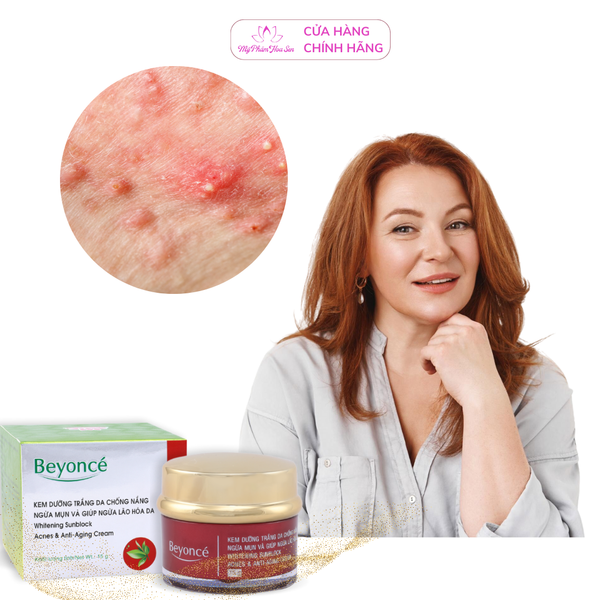 [BEYONCÉ] Kem Dưỡng trắng, Ngừa mụn, Ngừa lão hóa da