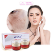 [ALYNA - KEM CẶP] Kem Nám - Hỗ trợ mờ thâm sạm