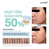  Phấn nước dành cho da dầu mụn Dr.PONG Acne Ace Longwear Cushion 15g 