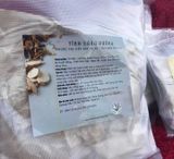 Thuốc bắc điều trị liệt dây 7 ngoại biên