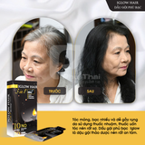 Dầu gội phủ bạc-IGLOW HAIR