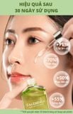  Serum siêu cấp ẩm và phục hồi da Lagumi Calendula Super HA & B5 30ml 