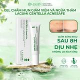  Gel chấm mụn LAGUMI giảm sưng đau sau 8h, Kem chấm mụn giảm viêm thâm an toàn & dịu nhẹ cho mẹ bầu và da nhạy cảm 15g 
