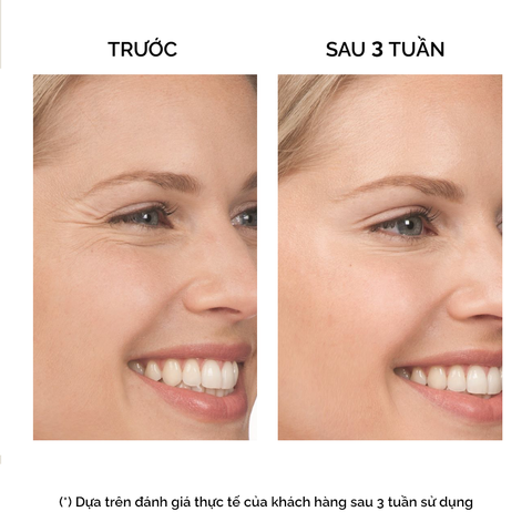  B LIKE CONCENTRATE 30ml (Tinh chất xóa nhăn hiệu ứng Botox) - 9812 