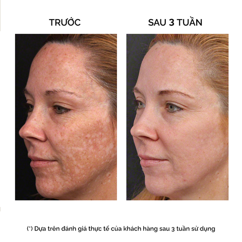  DERMABRIGHTENING CONCENTRATE 14x10ml (Tinh chất phấn nano trắng da) - 6278 