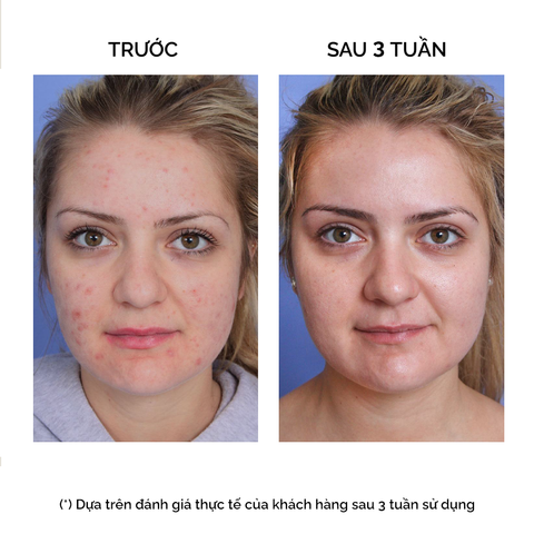  VITA-K INTENSIVE CONCENTRATE 6x2ml (Tinh chất siêu hồi phục VITK) - 7961 