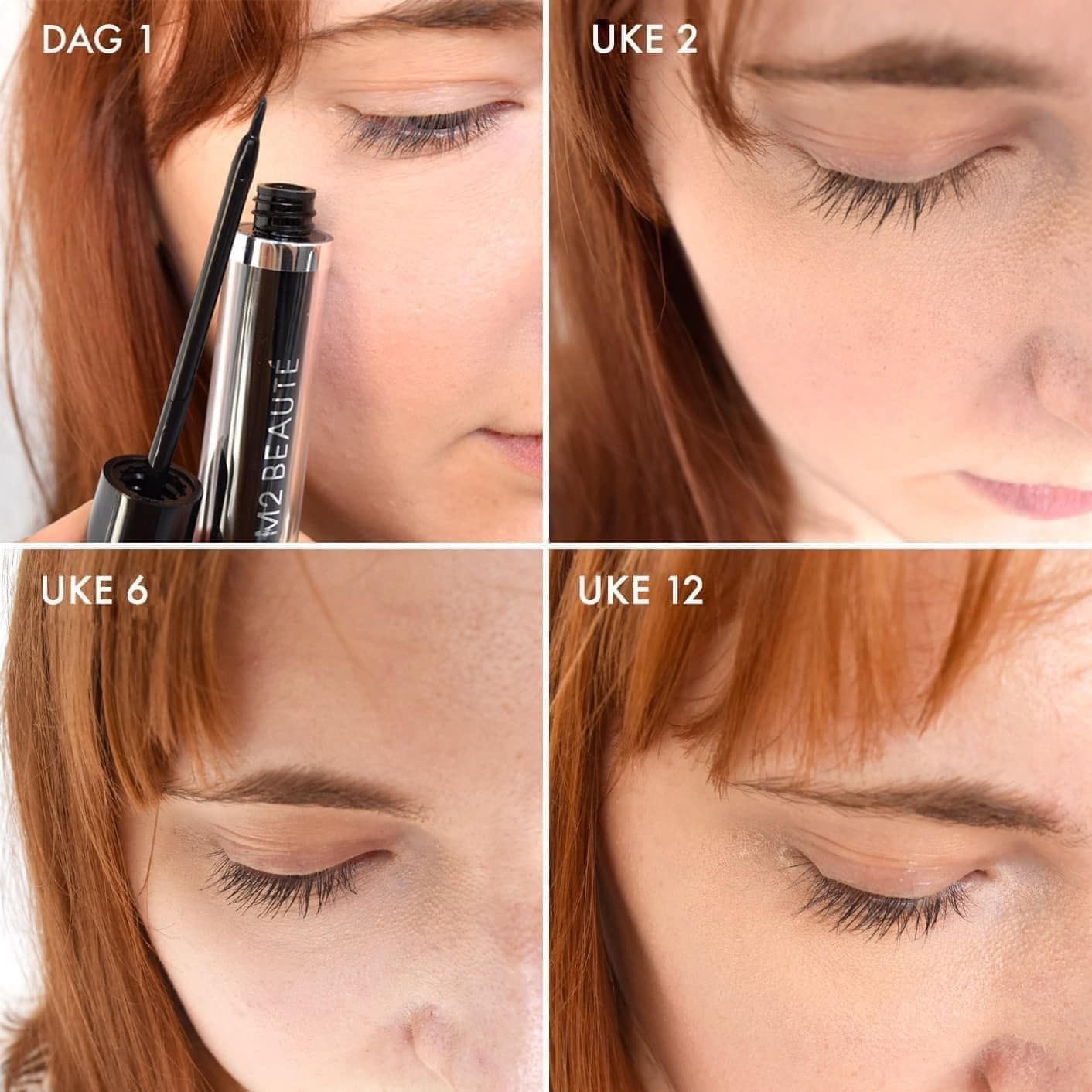 Bộ mọc tóc, mọc mi M2 Beaute