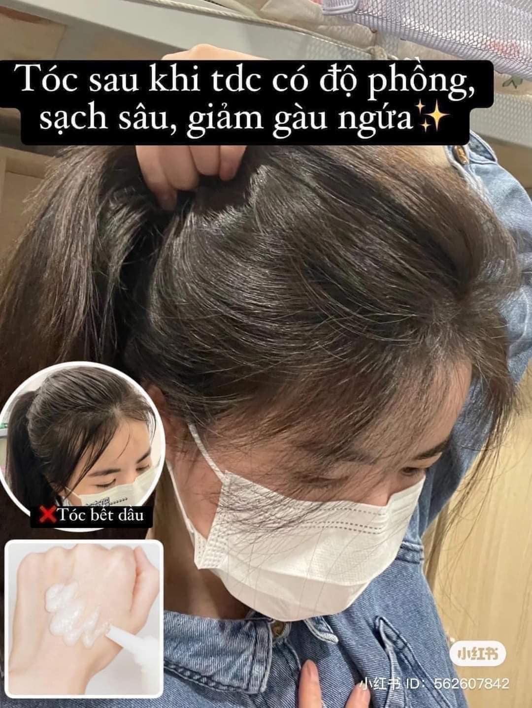 Tẩy tế bào chết da đầu Aromatica