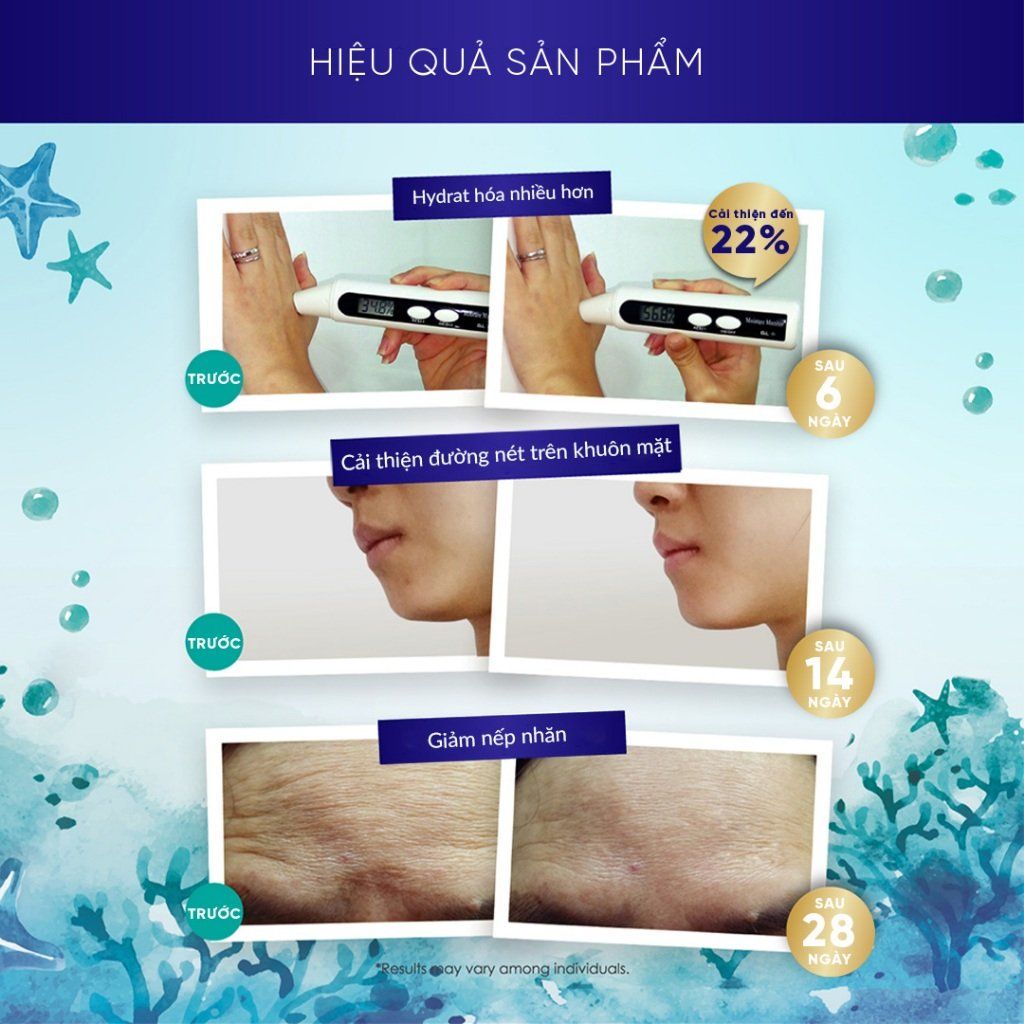  Kinohimitsu Marinegem Collagen 180G| BỘT UỐNG COLLAGEN KHOẺ DA TÓC MÓNG, XƯƠNG KHỚP 