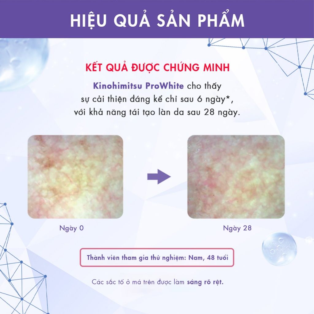  Kinohimitsu Prowhite 8G | BỘT UỐNG TRẮNG DA, CẢI THIÊN ĐỐM NÂU, DA XỈN MÀU 
