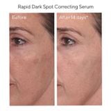  Serum Murad Rapid Dark Spot Correcting - Tinh chất giảm thâm nám nhanh (30ml/Chai) 